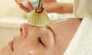 mesolifting procedure for skin rejuvenation